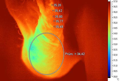 IR termografie oboustrann� varikok�la lev� bo�n� projekce