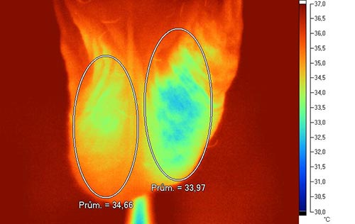 IR termografie - oboustrann� varikok�la �eln� projekce